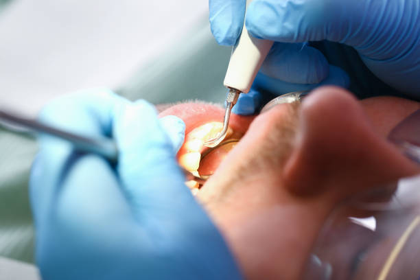 Best Emergency Broken Tooth Repair in Juno Ridge, FL